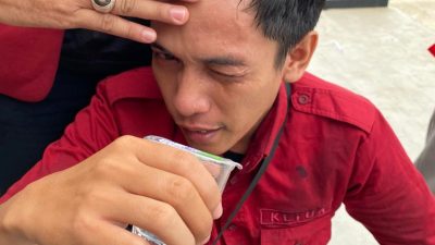 Ketum IMM Sulbar Jadi Korban Tindakan Refresif Oknum Kepolisian
